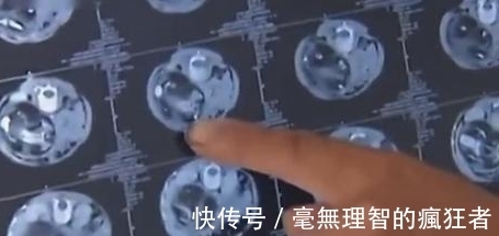 婴儿|2岁小孩说肚子痛,妈妈带去检查,竟然发现小孩怀孕肚子有一婴儿