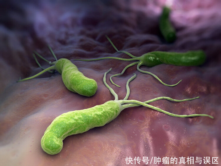 致癌物|感染8亿中国人的1类致癌物，不仅致癌，还可能抑制免疫治疗效果
