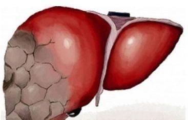 总是睡不着,半夜莫名醒来?或是这三种疾病在打招呼,重视起来