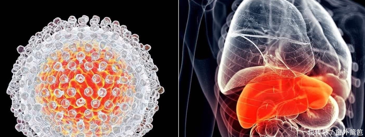 详解传染病四项,乙肝,丙肝,梅毒,艾滋