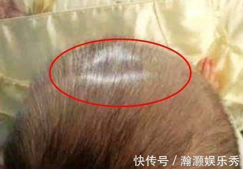 带娃|妈妈偷懒的带娃方式,差点把2个月宝宝差点弄成脑瘫,医生:无知