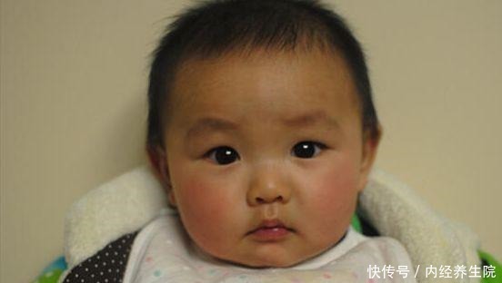 宝妈|儿科医生积食的娃会出现“3反常”,越拖越伤脾,家长别疏忽!