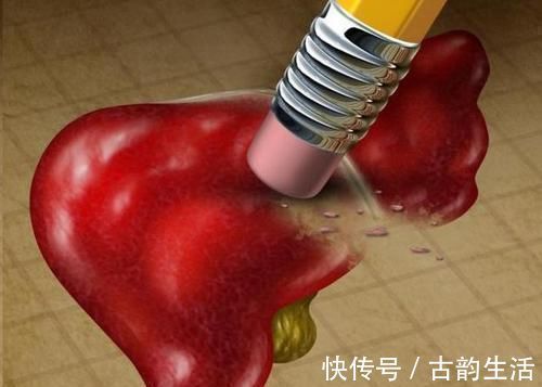 血脂|高血脂的“救命恩人”来了,多吃这3物,血脂乖乖降,血管软下来