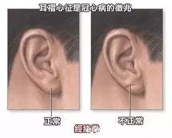 中医|“长寿脸”有这9个特征,“长寿招”不外乎这6个习惯,你占几个?