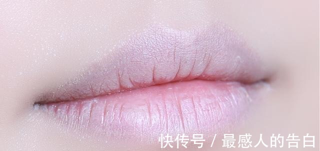 皮肤干燥 唇部护理有多重要没做好涂再贵的口红也是浪费,很多人都忽视了!
