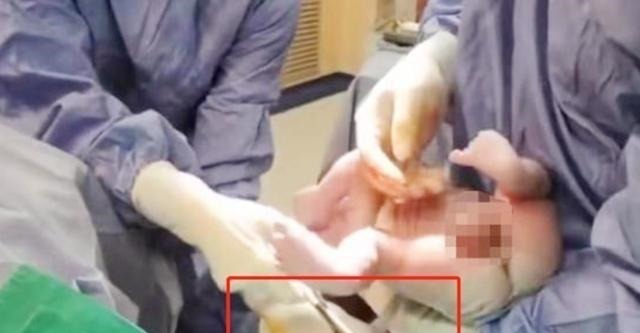 爸爸妈妈|宝宝出生后被带走十几分钟,这段时间经历了什么组图带你看真相!