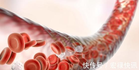 果酒|血稠的“稀释剂”找到了,饭前1口,血液不稠,血管回到十八岁!