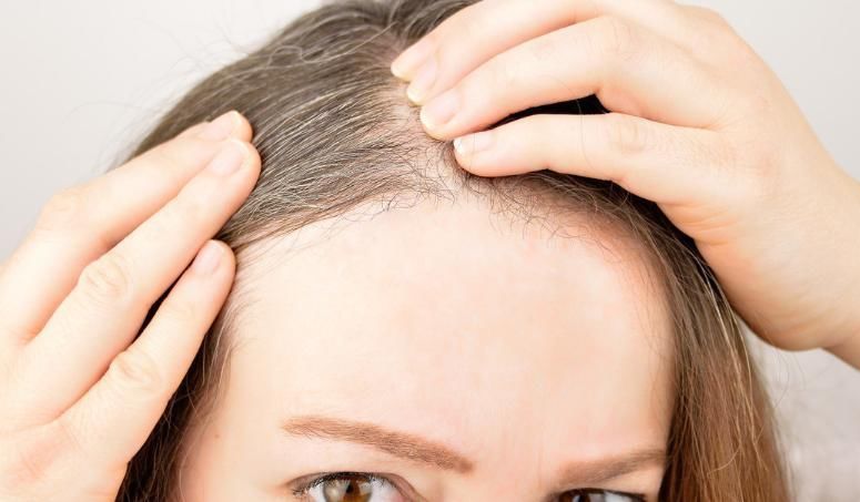 早生白发先不要发愁,送你一个方法,只花时间不花钱,来试试吧