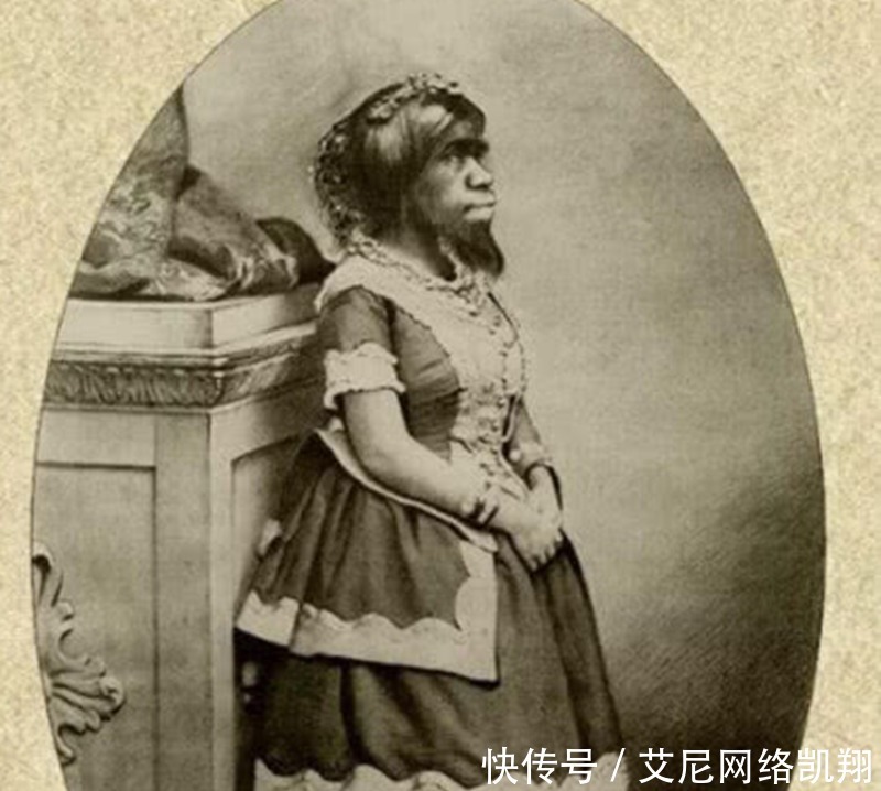 研究|她是最丑的女人，以为遇到真爱却嫁给渣男，死后被研究了153年