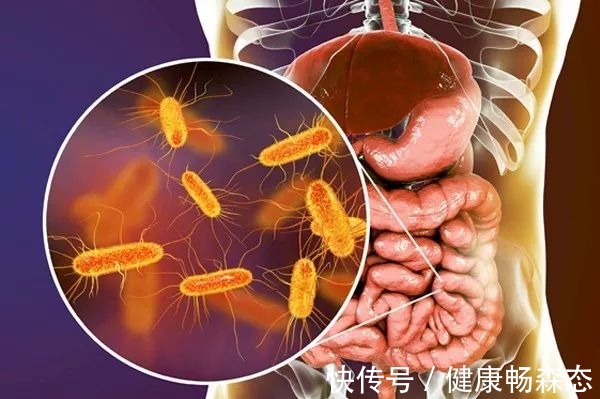 of|为什么益生菌能减肥?科学家:这3点是关键
