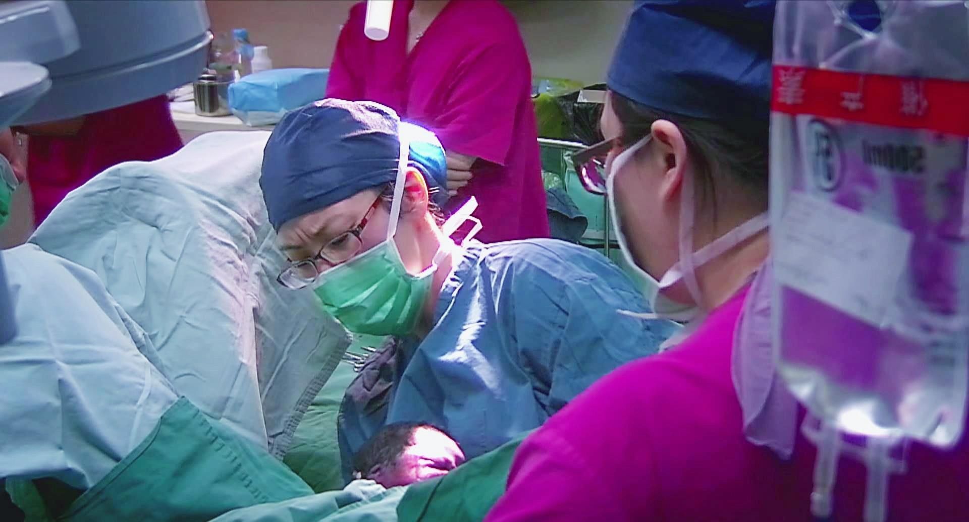 宁愿肚子上留疤,也不愿意顺产,女明星为什么会如此钟爱剖腹产