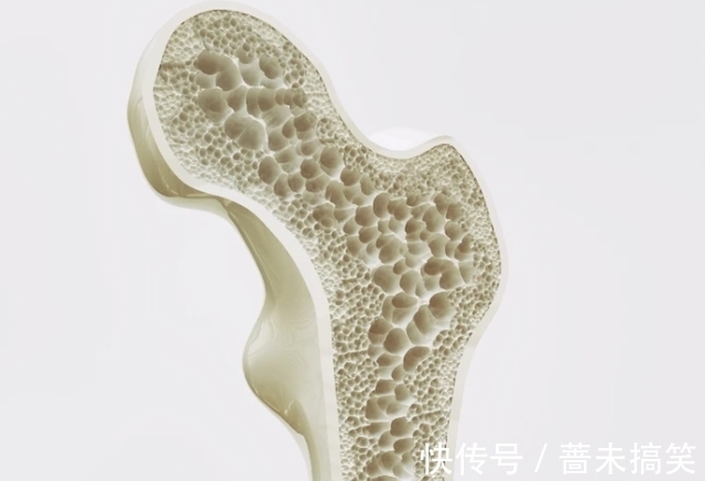 钙质|骨科医生提醒:50岁以后,常吃3种食物,骨骼或能“坚硬如钢”