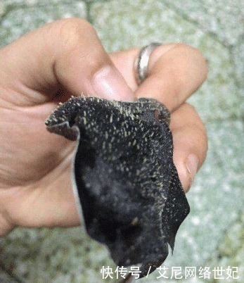 粉刺|皮肤科医生:这几种洗面奶含“剧毒”,你的皮肤不差谁差