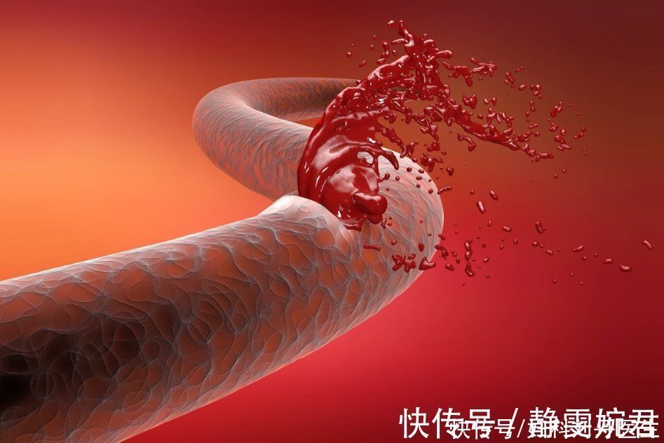 繁殖|癌细胞是如何“杀死”一个人的?它喜欢你做这3件事,别给它机会