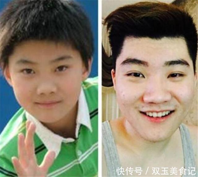 眼睛|什么叫“毁容式长大”?脸上没有这些特征,小时候再好看也白搭