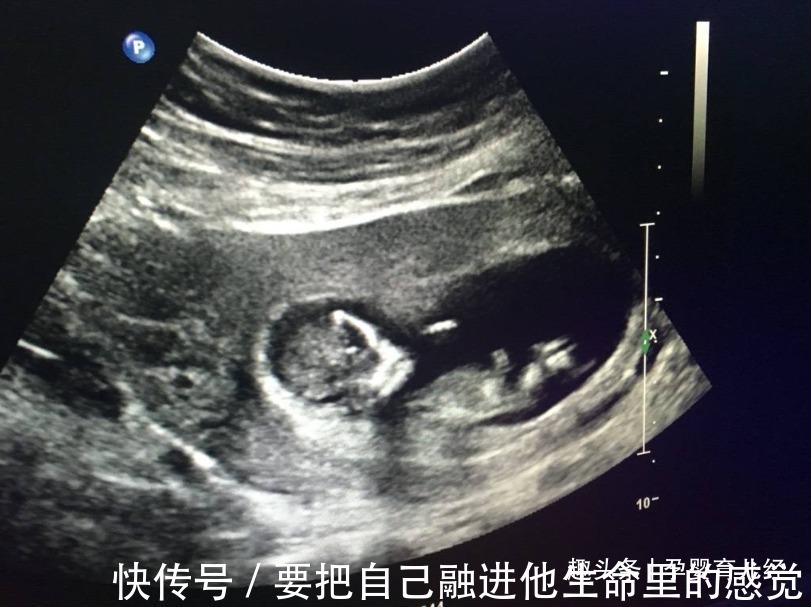 性别|怀孕后,想知道胎儿性别是什么,可以尝试这些方法来鉴别