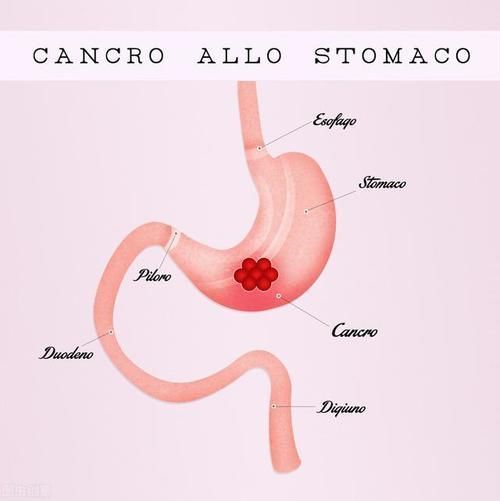 患者|慢性胃炎迟迟不愈?也许是这2方面没做好吧?