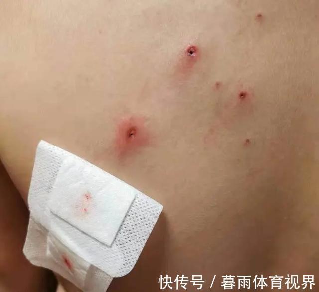 学校|孩子被欺凌、身上20处铅笔尖刺入、差点眼瞎:如何才能保护孩子