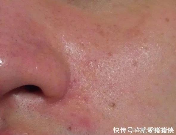 秋季|皮肤“干净”的女生,才是真的气质好看!这个护肤细节很值得学