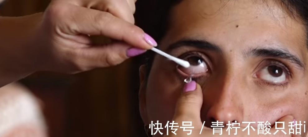 晶体|未解之谜:22岁女孩眼睛流出“水晶”,一天产生50颗晶体