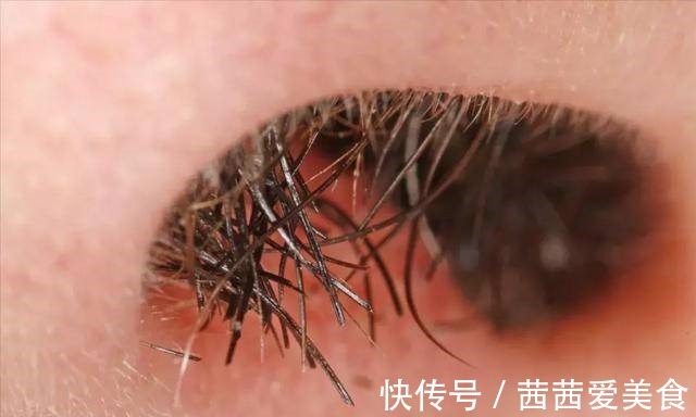 鼻毛|男性的鼻毛“窜”出来,是何原因?鼻毛旺盛意味着什么?能拔吗?