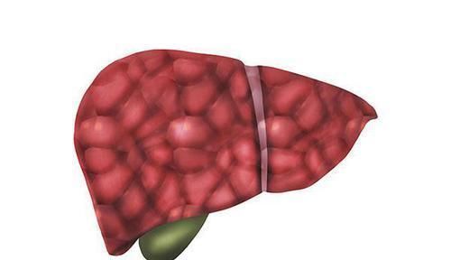 肝脏是否出现硬化,手脚会先知,肝硬化后手脚有哪些表现