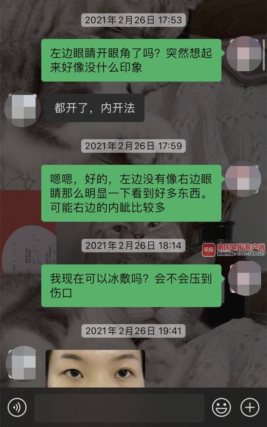 女子|南宁一女子交1.2万元去整形，术后发现医生少做一个项目，至今索赔无果