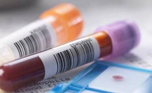 流产|这两种血型对孕妈意义特殊,怀头胎时最好别流,第一个宝宝很重要