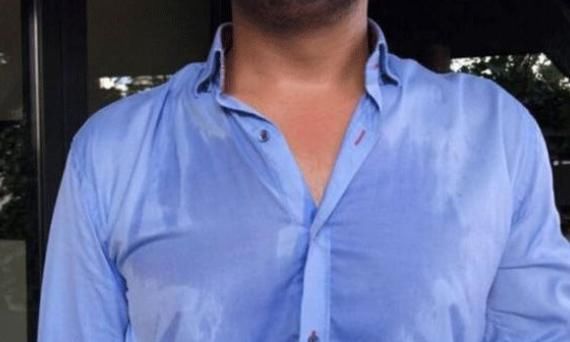 阴虚体质|动不动就出汗和不出汗的人，哪种人的“体质”更好呢？你清楚吗？