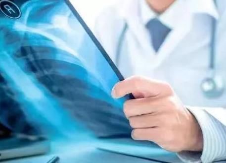 老钱|46岁男子戒烟一年后,查出肺癌,除了吸烟,1件事也是“帮凶”