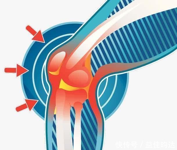 体征|肝脏不痛不痒，可当出现这6个体征时，可能你的肝正在坏掉