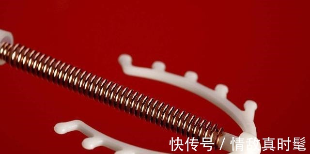 怀孕|孕妈生完孩子后要不要上环 看完这4点, 你再做决定吧!