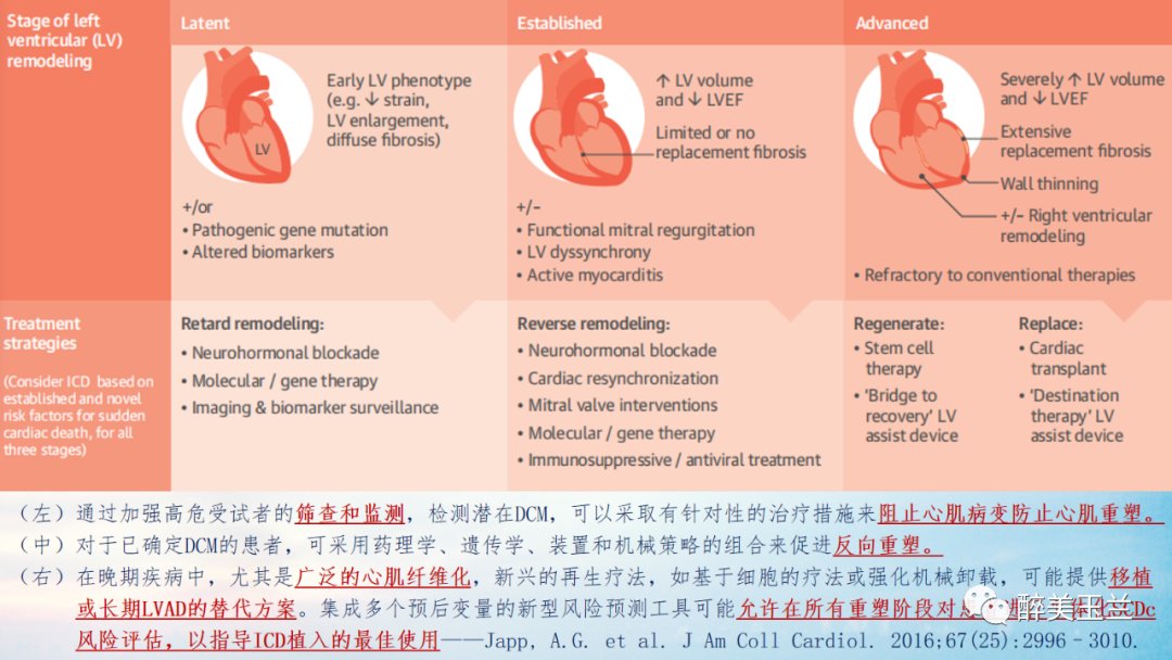 扩张型心肌病患者非心脏手术的全身麻醉一例|病例讨论 | 全身麻醉