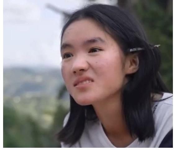 《變形計(jì)》李勒優(yōu)：臉上痘痘減少，回憶變形細(xì)節(jié)強(qiáng)忍難過(guò)