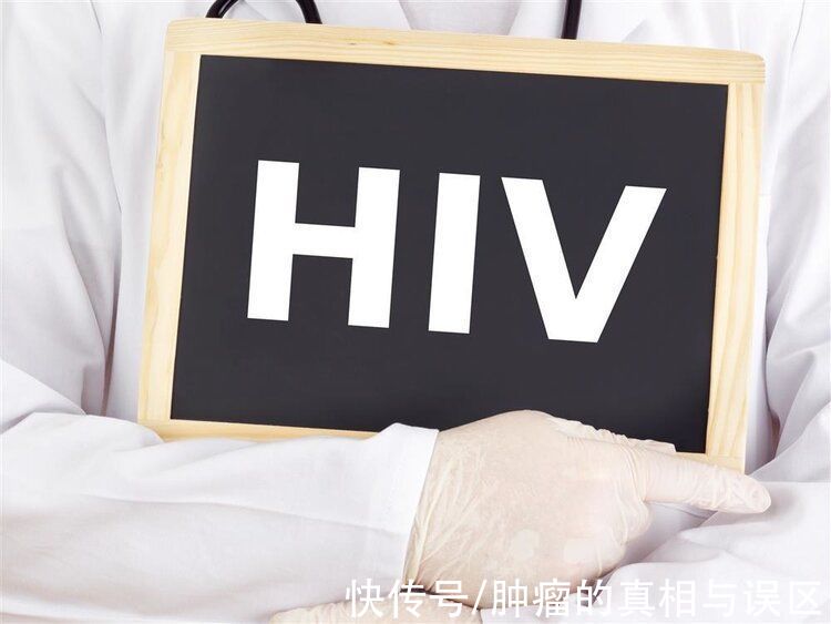 hiv|别错把艾滋病当普通的皮肤病！皮肤有5种异常，可能是HIV感染了