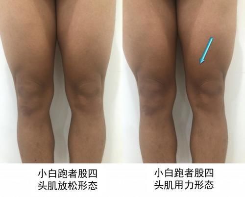 训练|坚持跑步给你留下训练痕迹了吗？跑者的十大形态特征