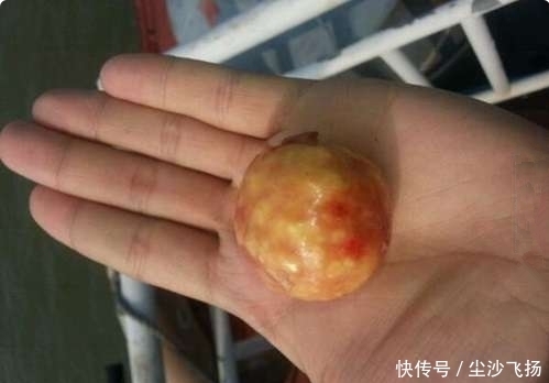 雷姓村民在瘦弱家禽体内掏出异物,意外收获250万