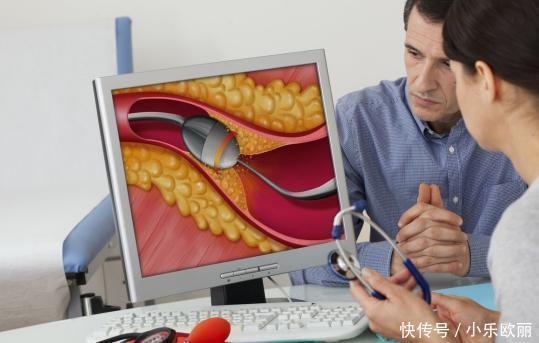 血脂高的人,多半有这3种共同“爱好”,你若没有,偷偷乐吧