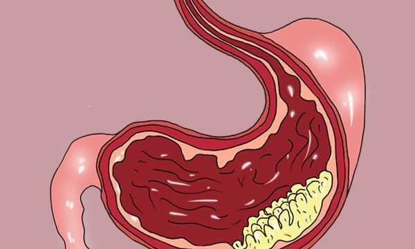 癌症患者|运动抗癌到底靠不靠谱?坚持跑步的癌症患者,得到了什么?