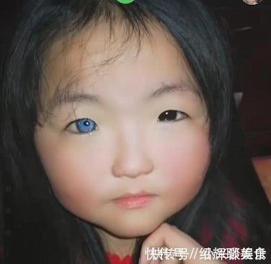 女孩天生“异瞳”走红,睁开眼那时,网友:动漫萝莉!