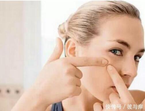 皮肤|痘印一直不消怎么办?试试这3个方法,助你摆脱痘印困扰