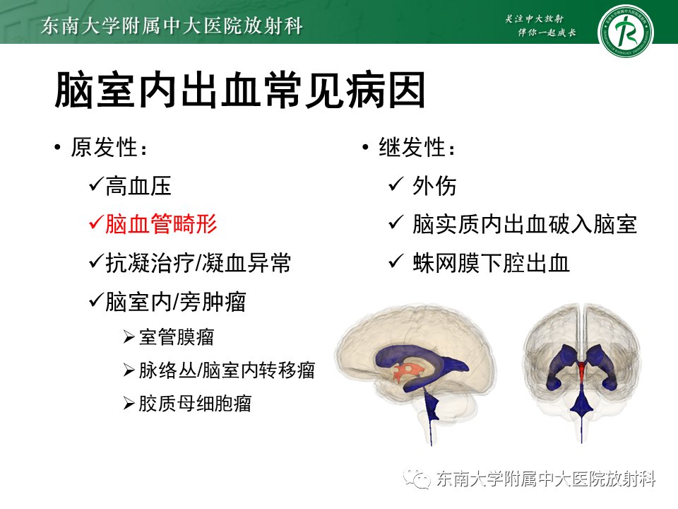 影像学|脑动静脉畸形影像学特征