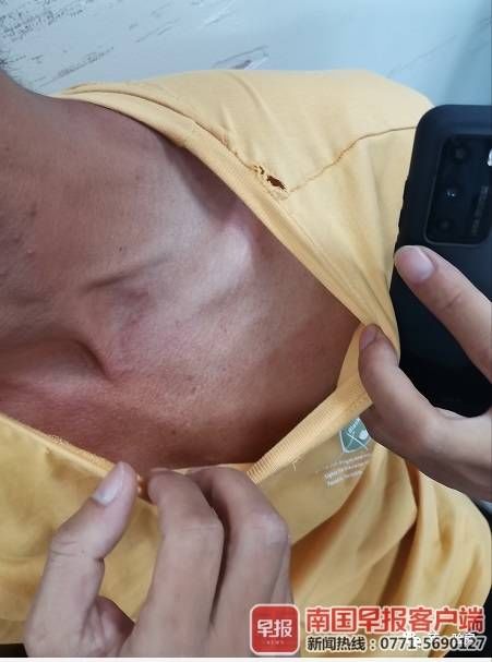 地板|验房师验房时遭人打伤报警，涉事者被传唤后称自己也需验伤