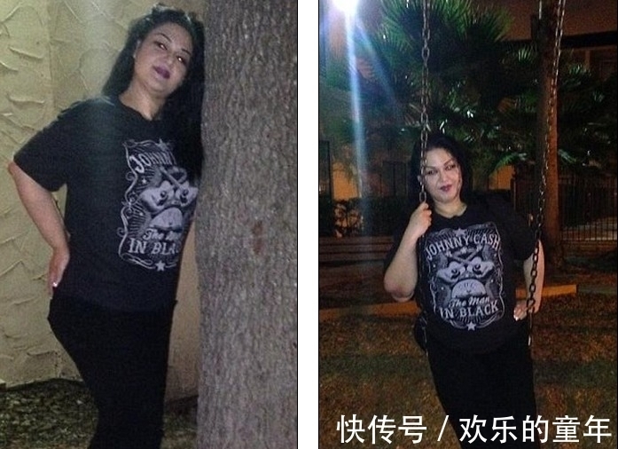 手术|1088斤胖女子经历2次手术,成功减掉648斤肥肉,堪称奇迹