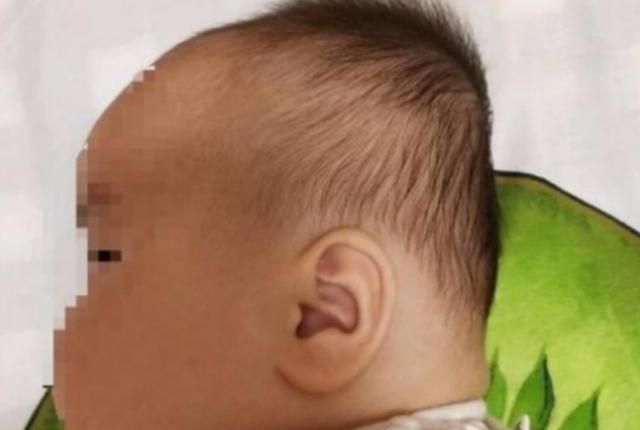 区别|“睡枕头”与“不睡枕头”的孩子,区别很大,影响颜值和身体