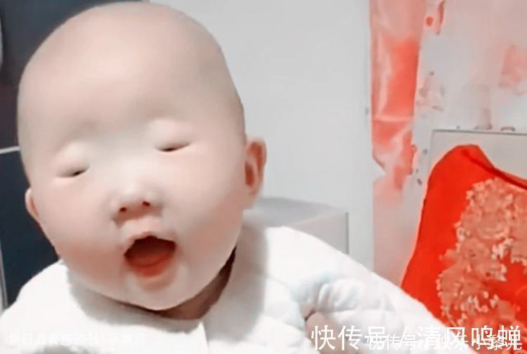 医生|90后新手宝妈闹“笑话”,以为生出没眼娃,医生检查后却笑出声