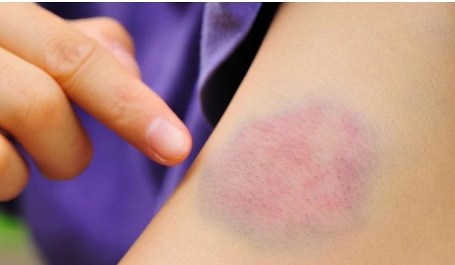 孩子|为什么越来越多孩子得白血病?医生:孩子有这5大异常,尽早就医