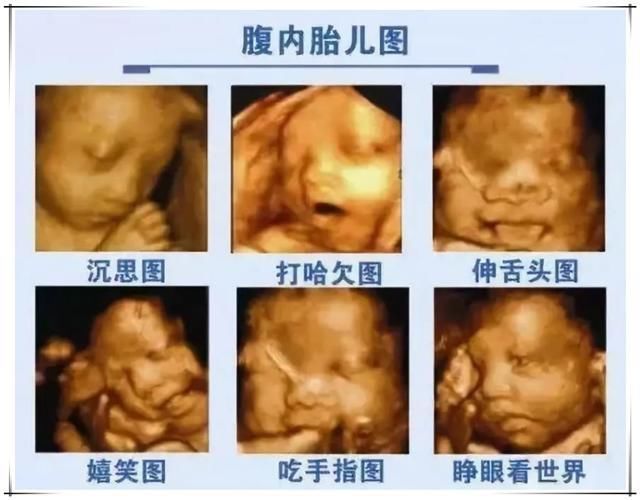 妈妈|胎宝在做四维时“好害羞”，折腾人还“白花钱”，怎样才会露脸？