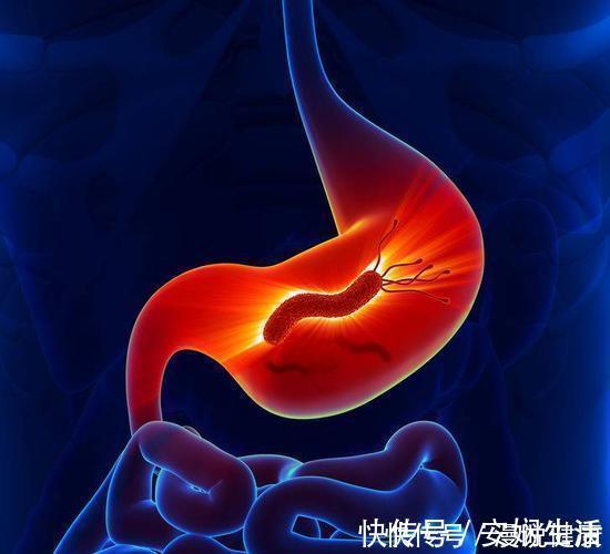 慢性胃病|感染8亿国人!幽门螺旋杆菌有多难缠?提醒:多喝1水,多吃2物