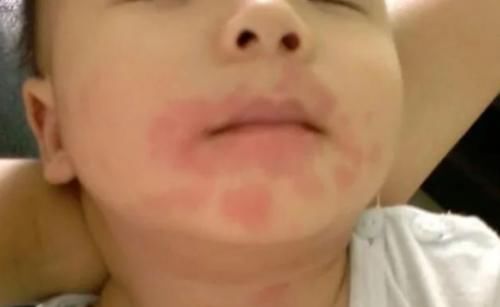 为何不能给宝宝吃“鸡蛋羹”？儿科医生劝诫多次，家长仍一意孤行